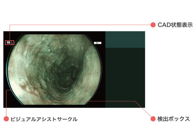内視鏡の様子