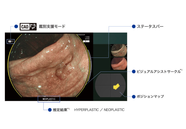 内視鏡の様子